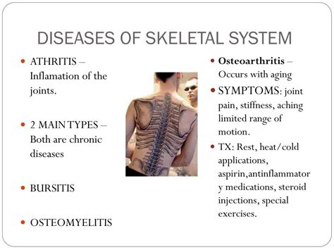 A diagram of skeletal system diseases, highlighting their causes and effects